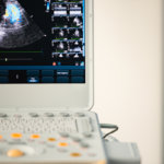 Ultrasound on computer