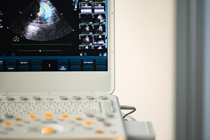 Ultrasound on computer