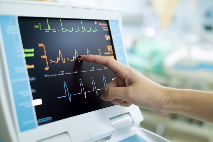 EKG Machine
